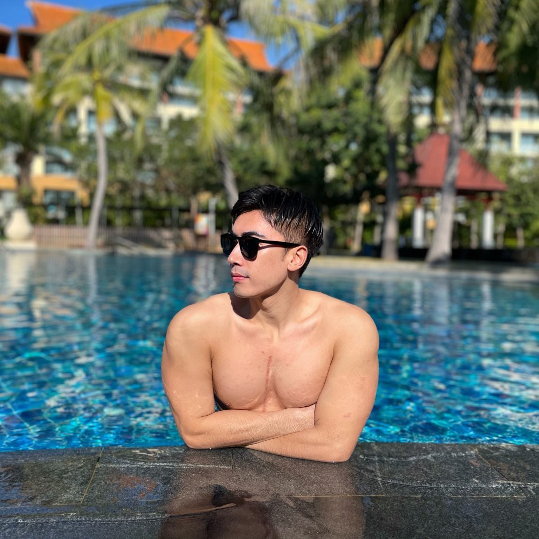 Louis Chen